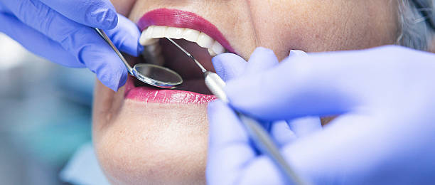 Best Emergency Cosmetic Dentistry (e.g., broken veneers) in The Hammocks, FL